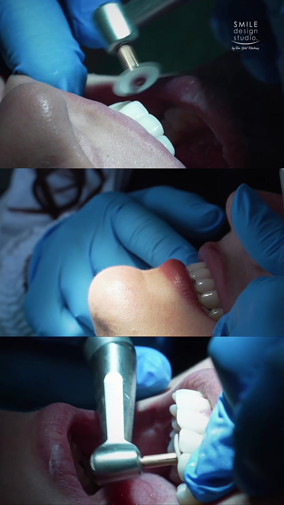 @SmileDesignStudio