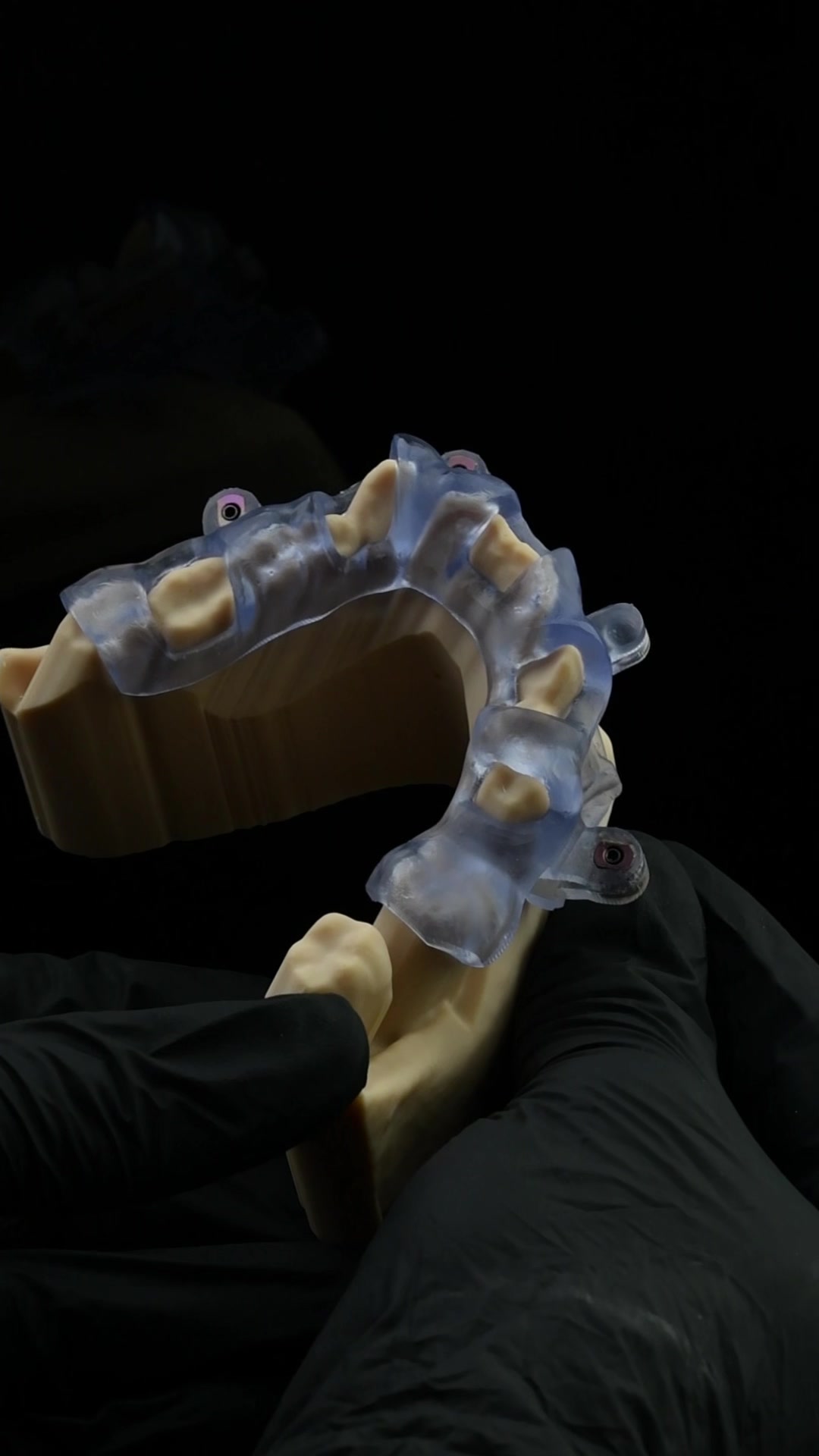 @Vivo Dental Lab