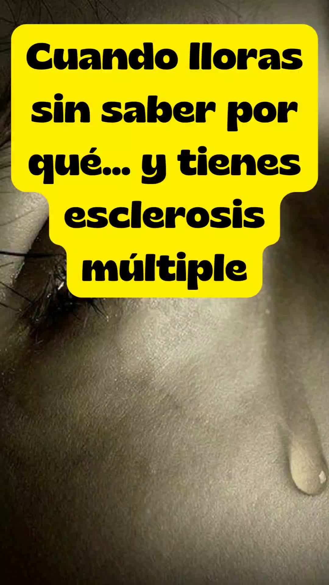 @Entendiendo la EM