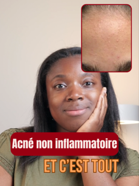 @Hyperpigmentation & Glow ✨