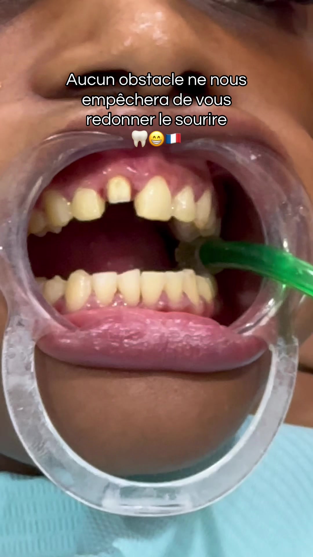 @Docteur Sourire