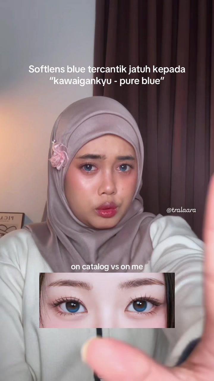 @Raa💖 | dry skin