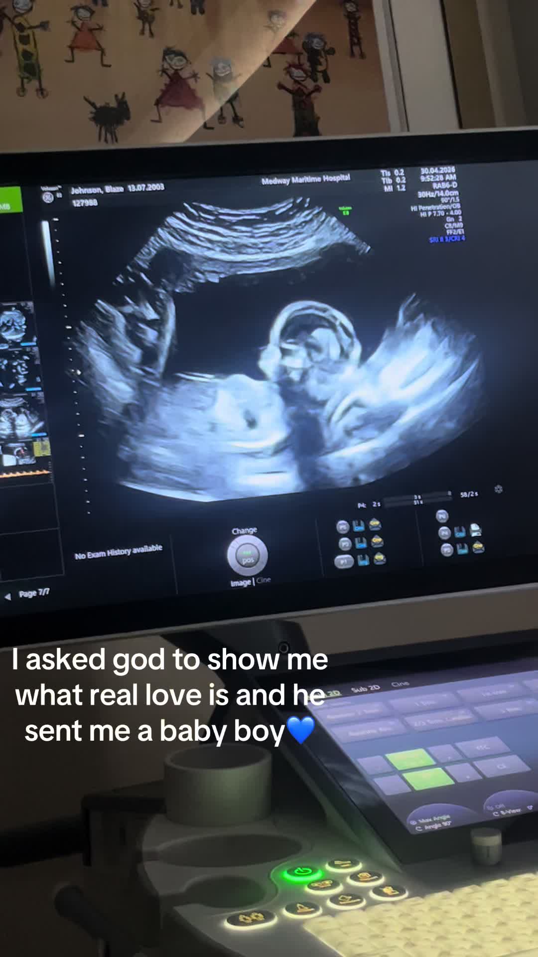 @BlazeLou🫐💙