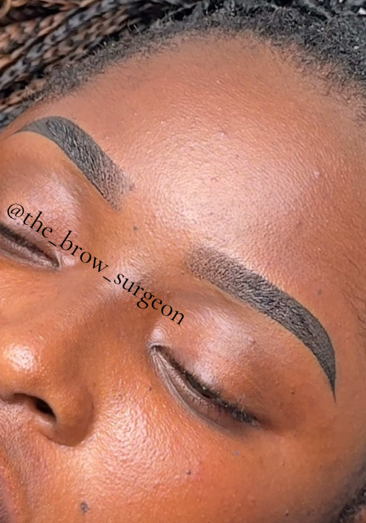 @the_brow_surgeon