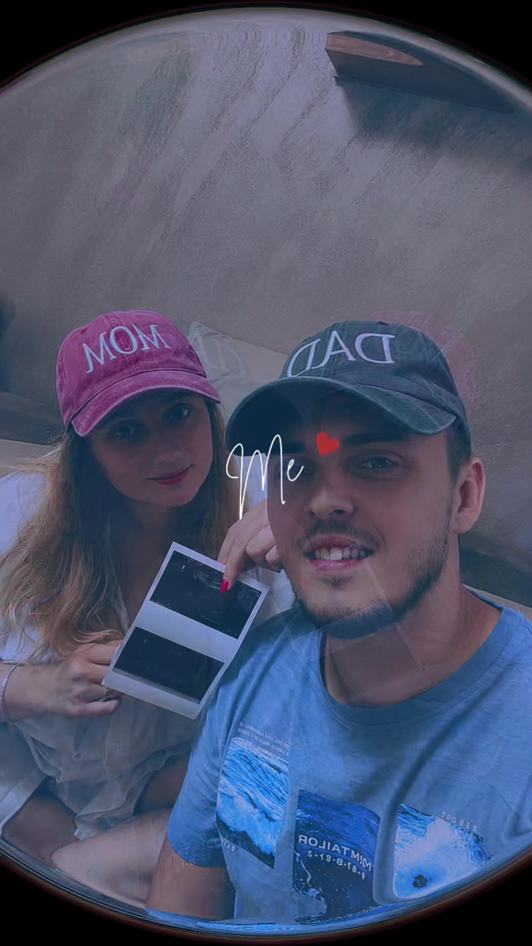 @Anca