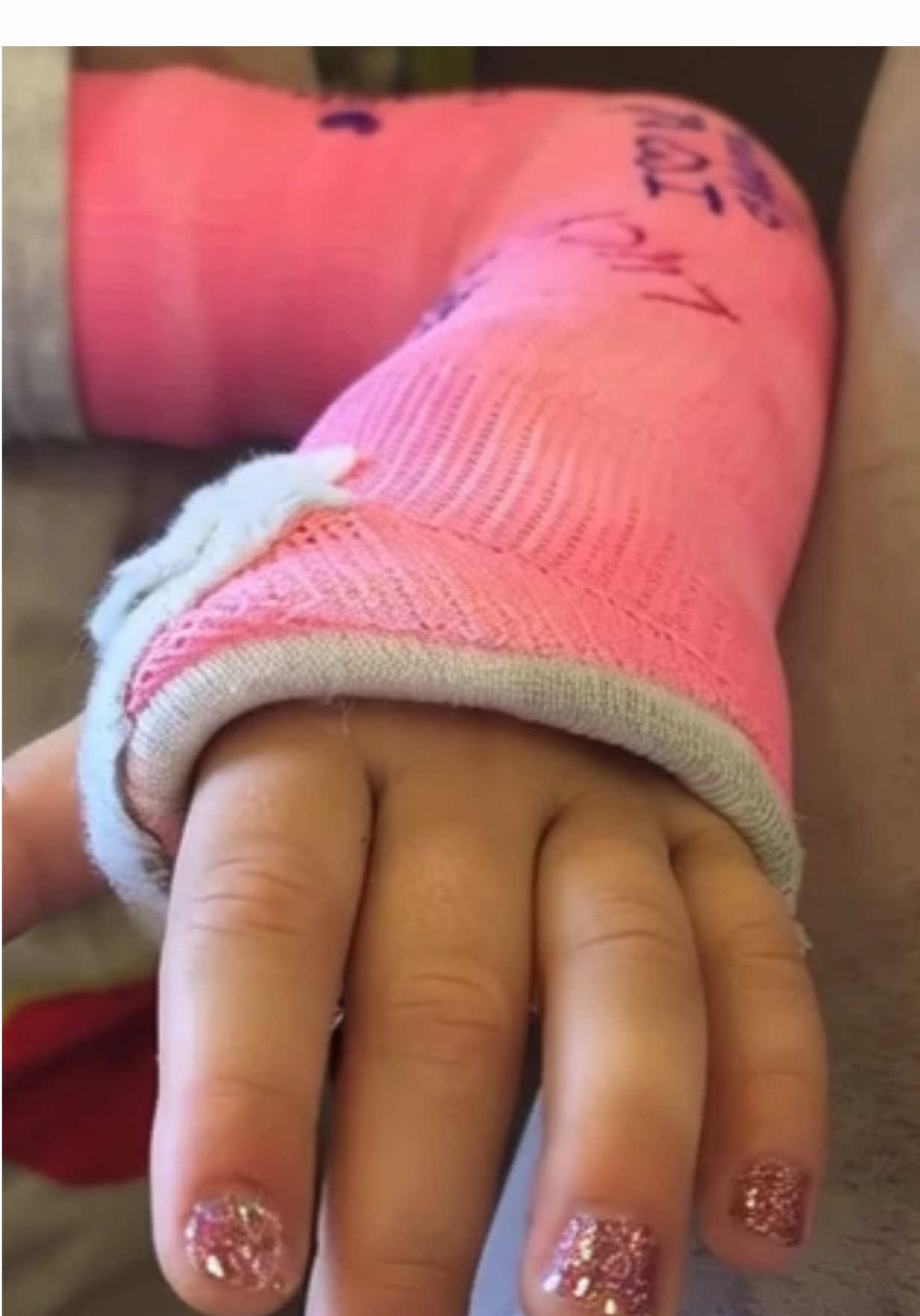 @Gips Fetish