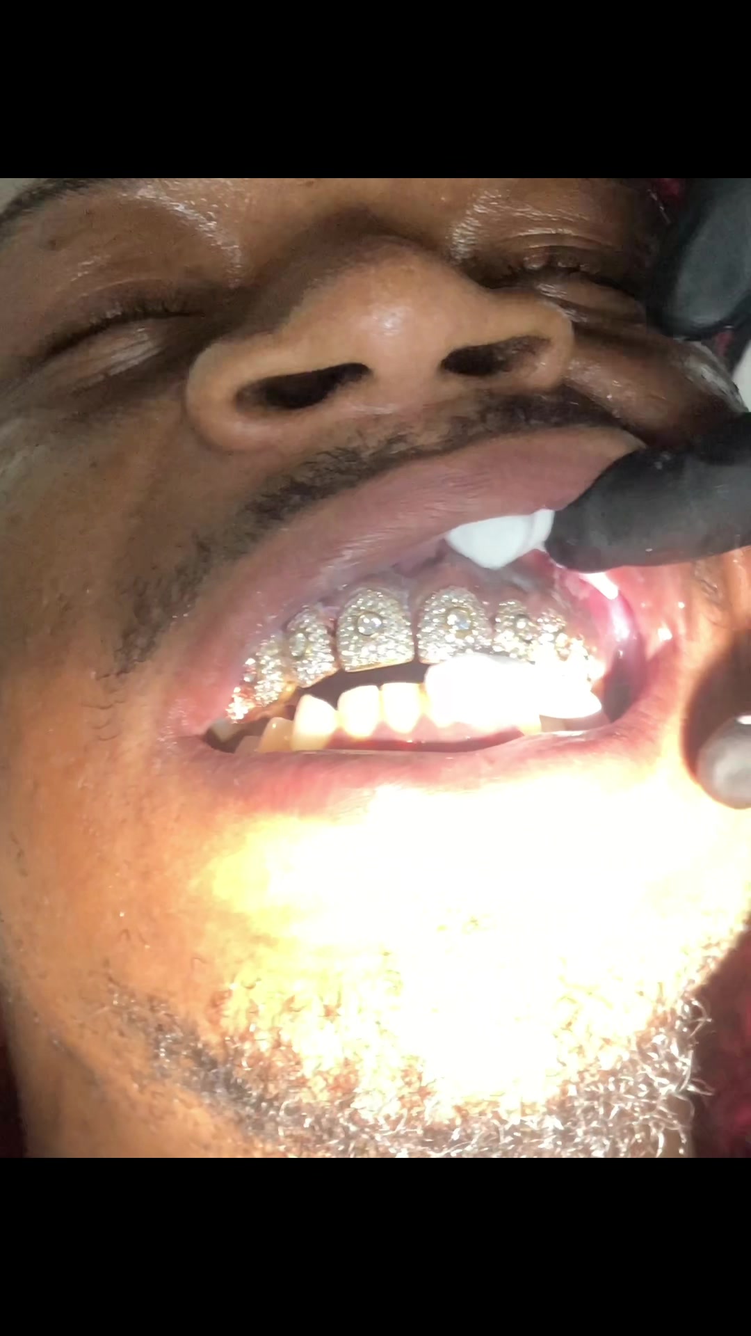 @AB