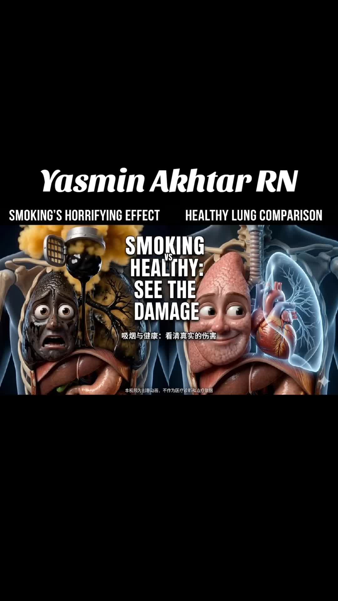 @Yasmin Akhtar RN