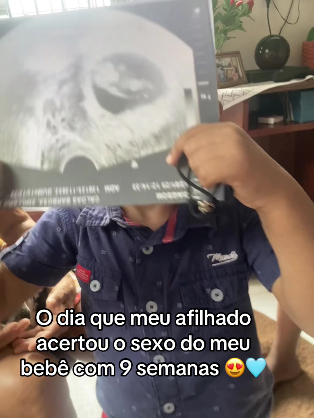 @emillyhildebrando520