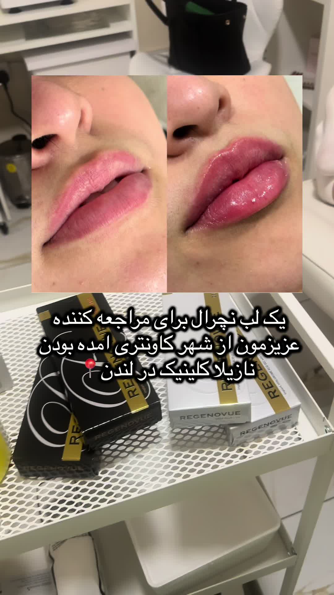 @Nazila beauty Clinic🇬🇧