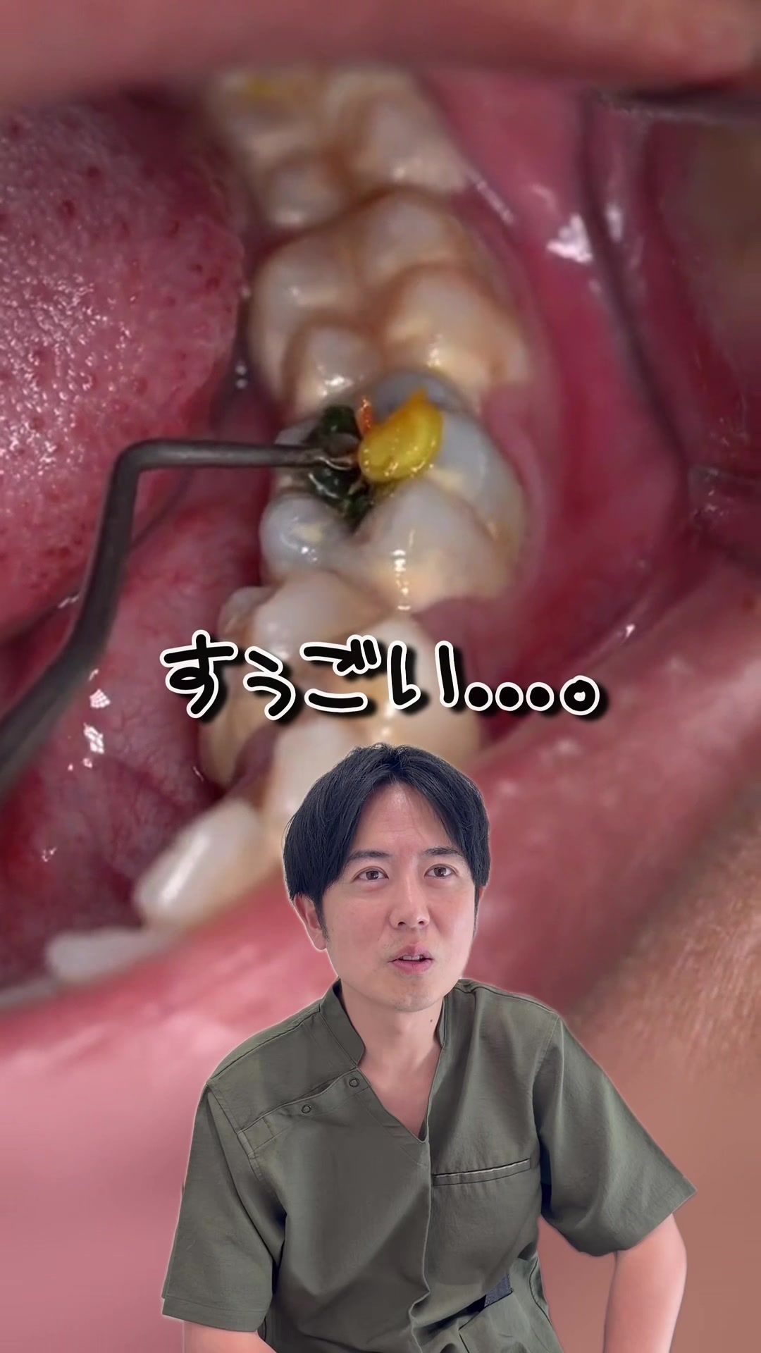 @Dr.山元(湘南歯科クリニック心斎橋院)
