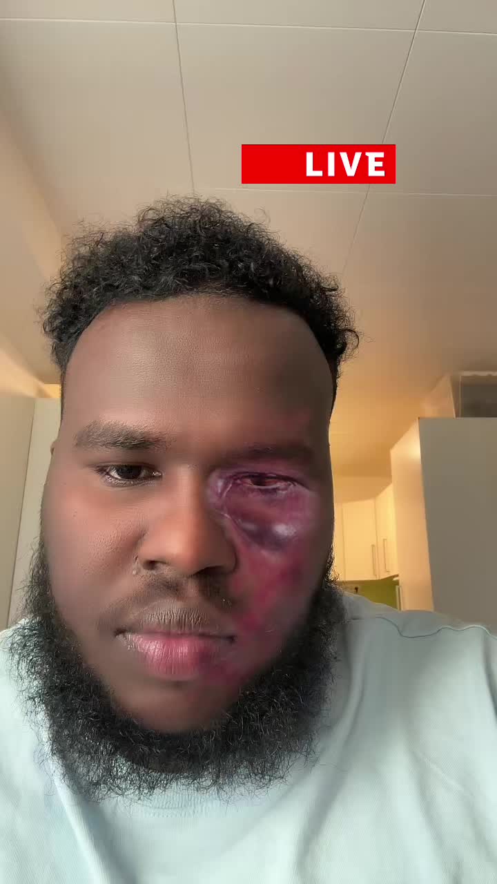 @Mudumala