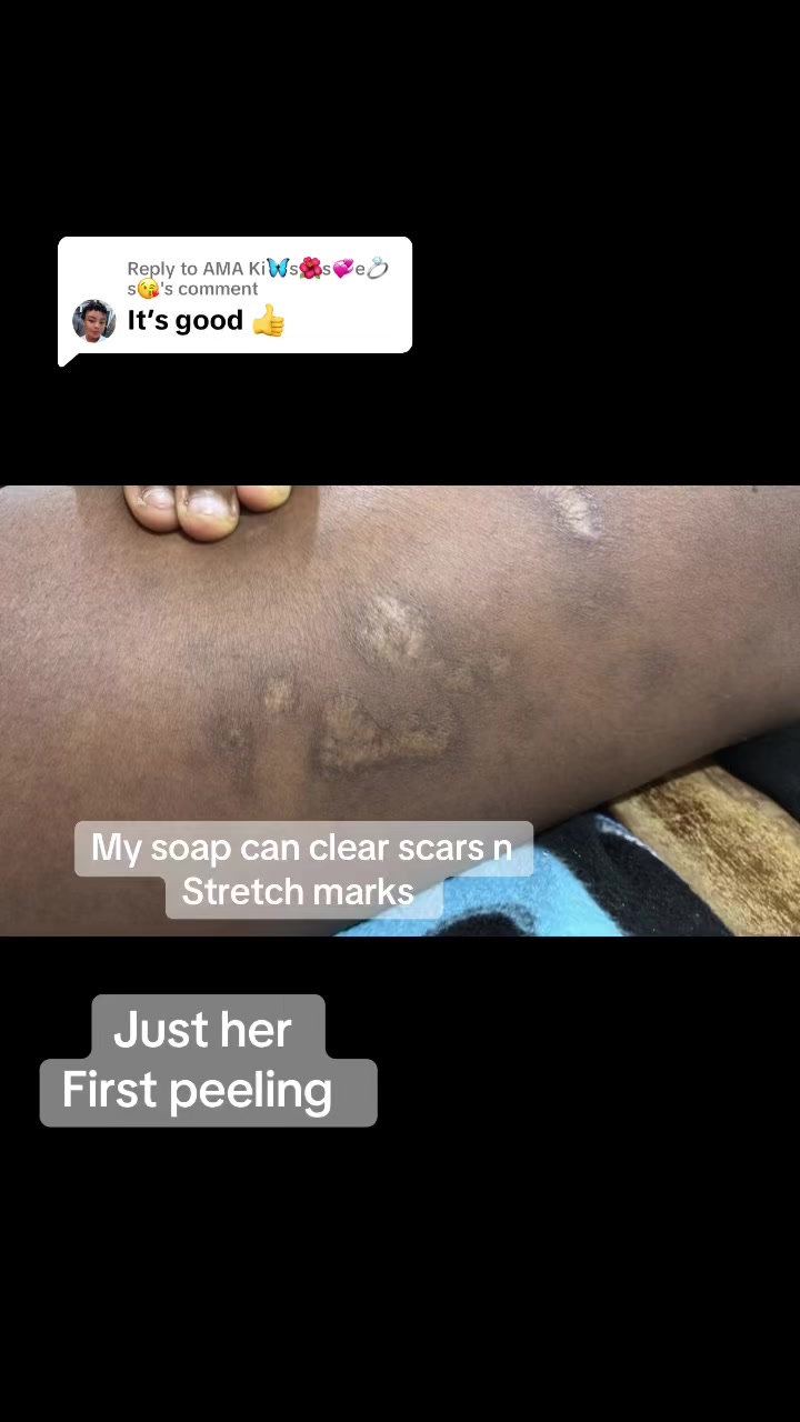 @@ Precious peeling soap