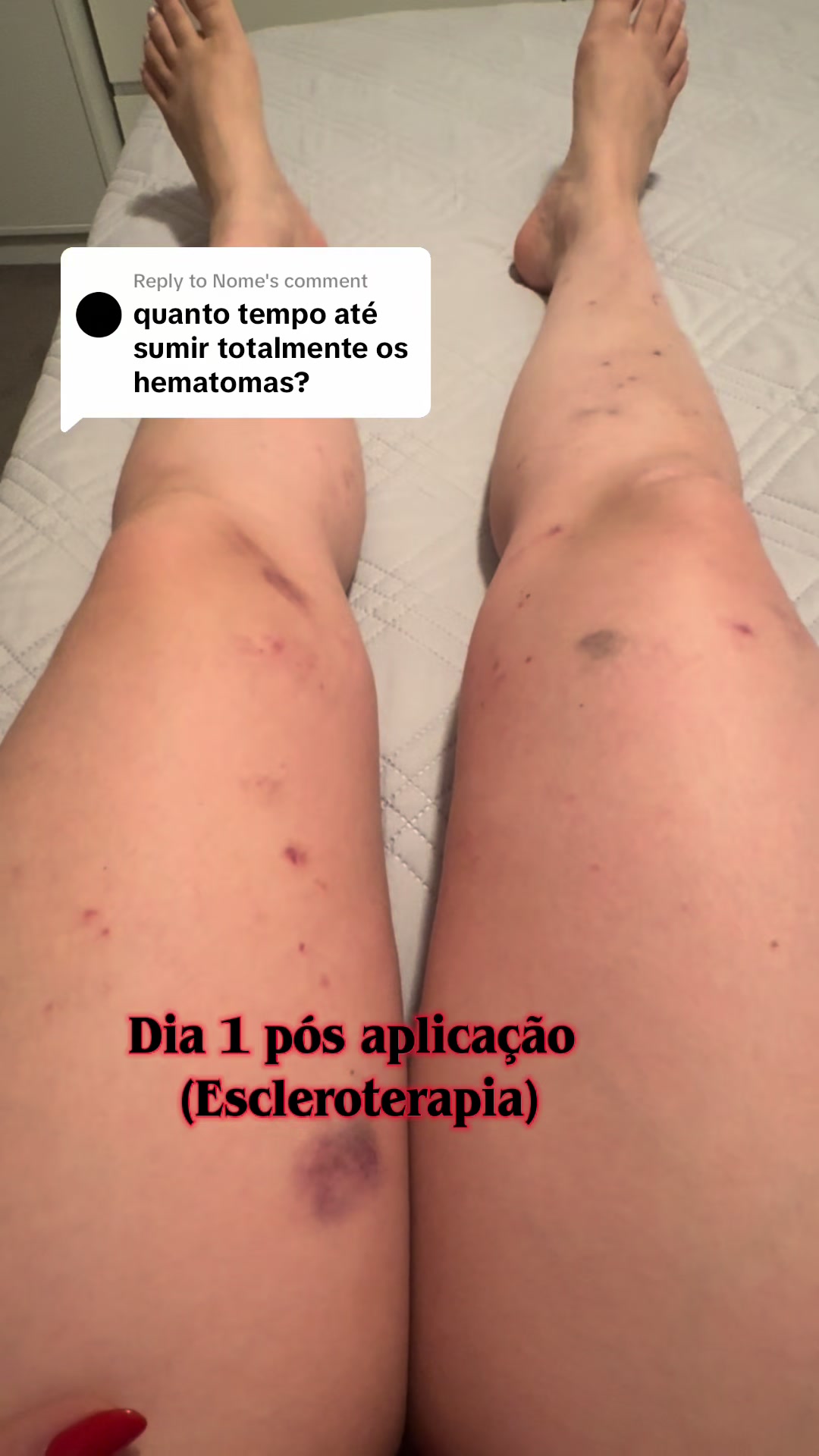 @Ingrid Peron