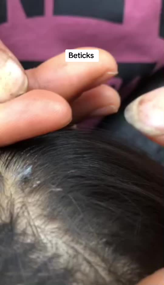 @bbbeee195