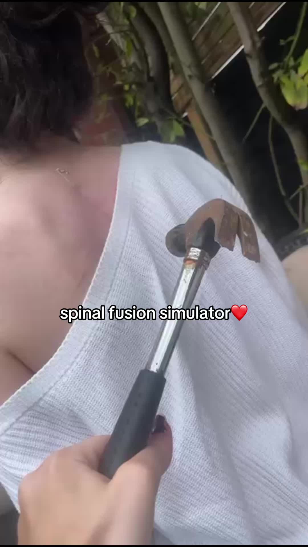 @ciaraxspinalfusion