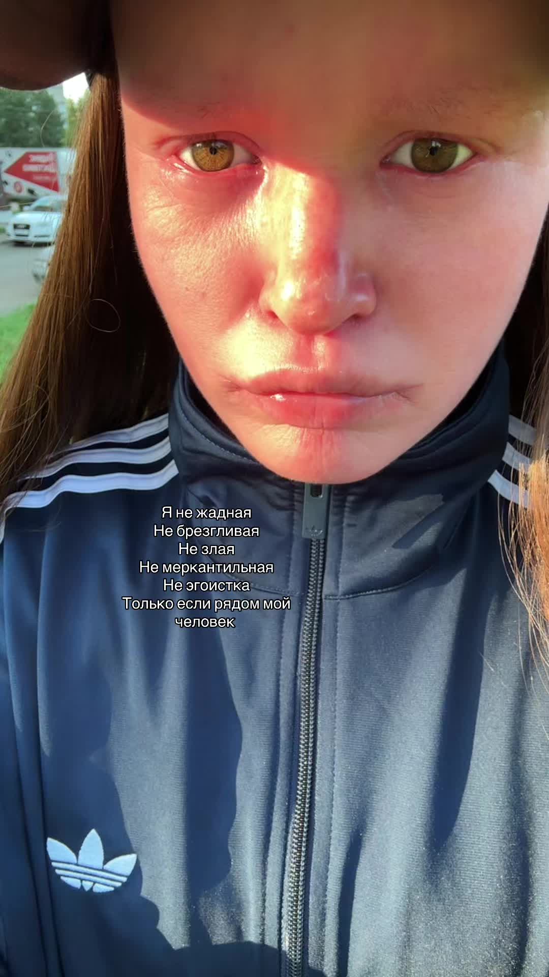 @Toxxzaaa