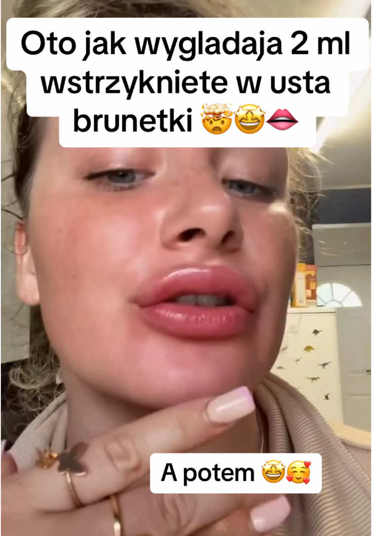 @Supreme Lips PL 🫦