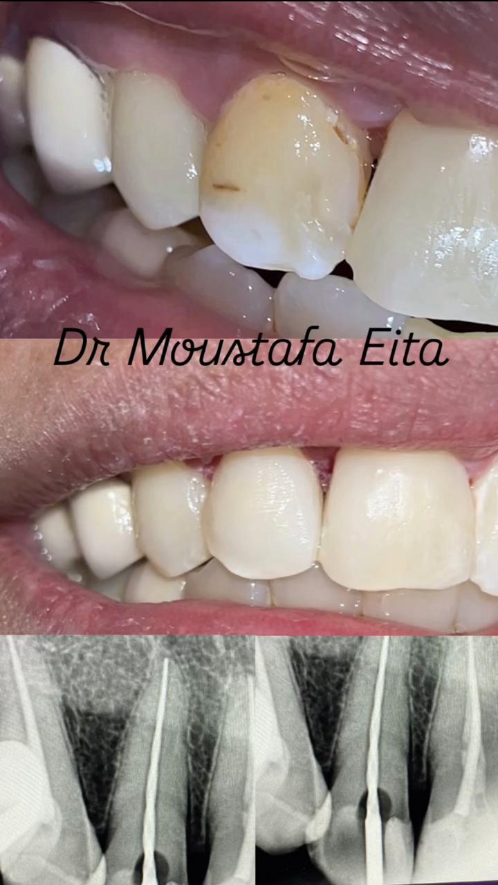 @Dr Mostafa Eita