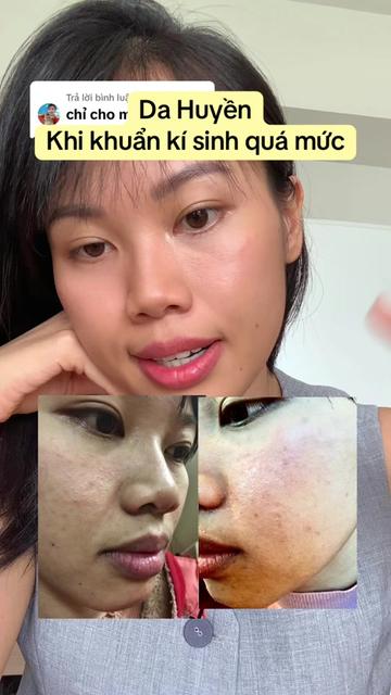 @huyendao_thaidoc
