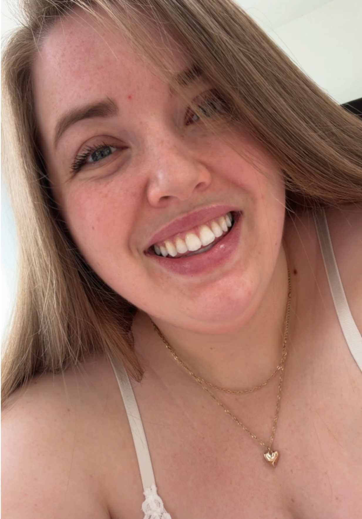 @Amber Louise ๐
