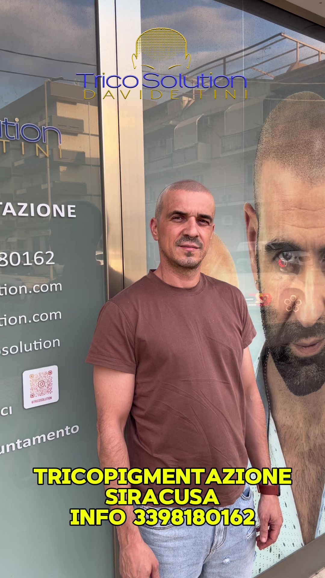@TricoSolution di Davide Tini