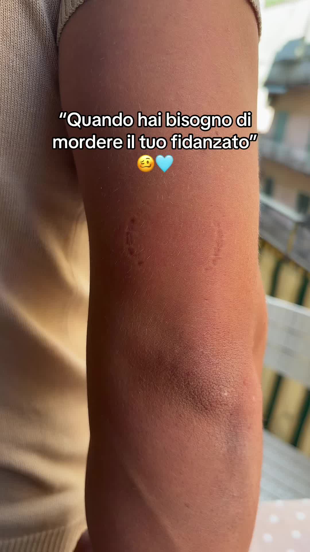 @Rosa Perrotta