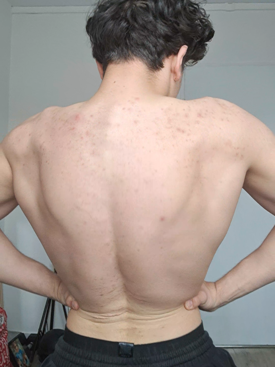 @Body king