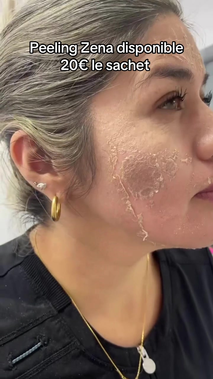 @peeling_zena