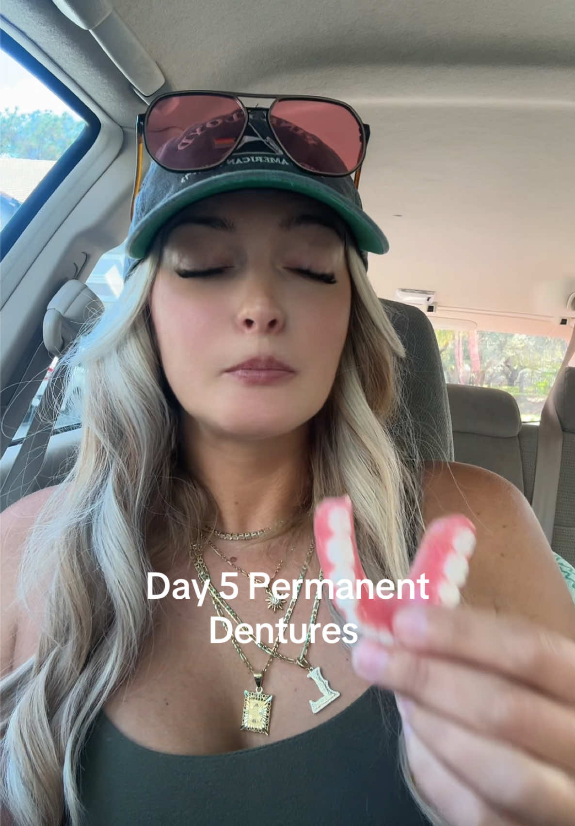 @Sarah | Dentures | UGC | RVing