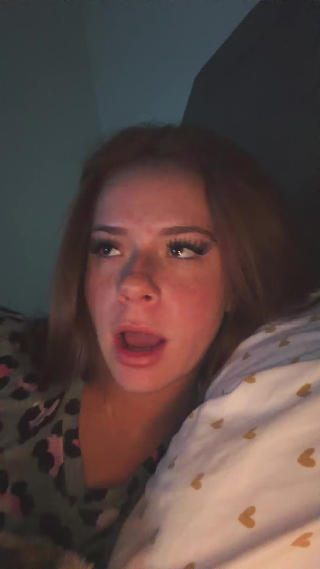 @harperpigmintation