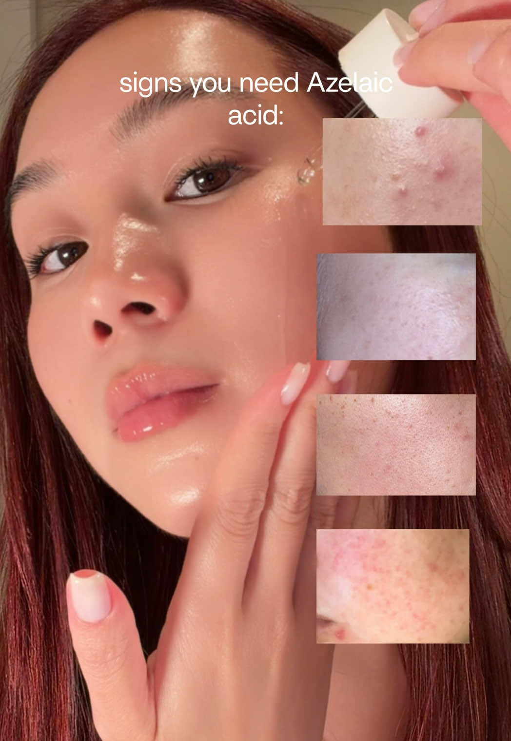 @Song Of Skin