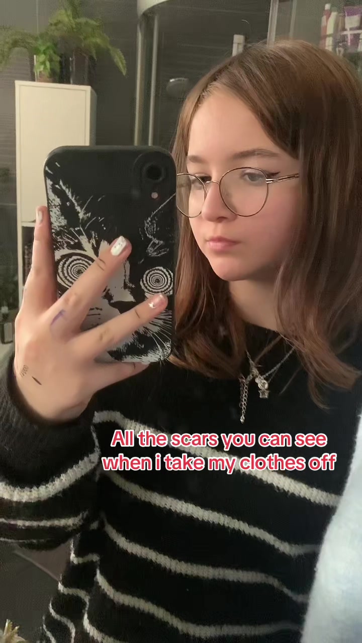 @Chcipni
