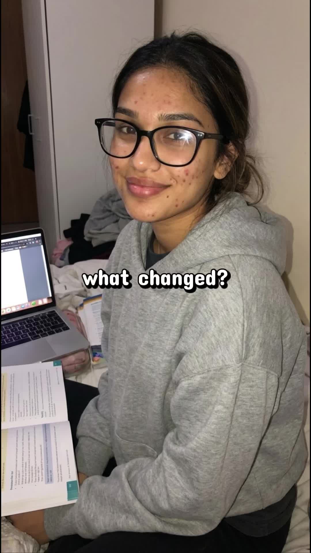 @Aneeka🦦