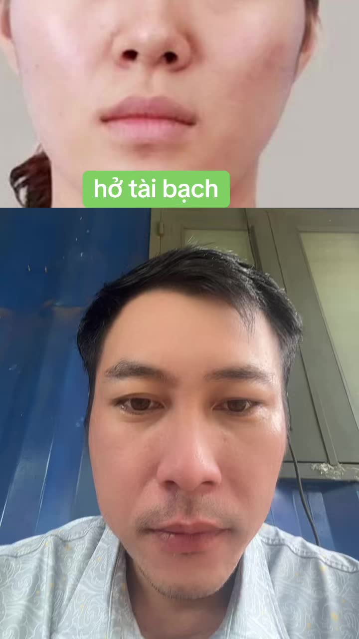 @Tuệ Nhãn ✅
