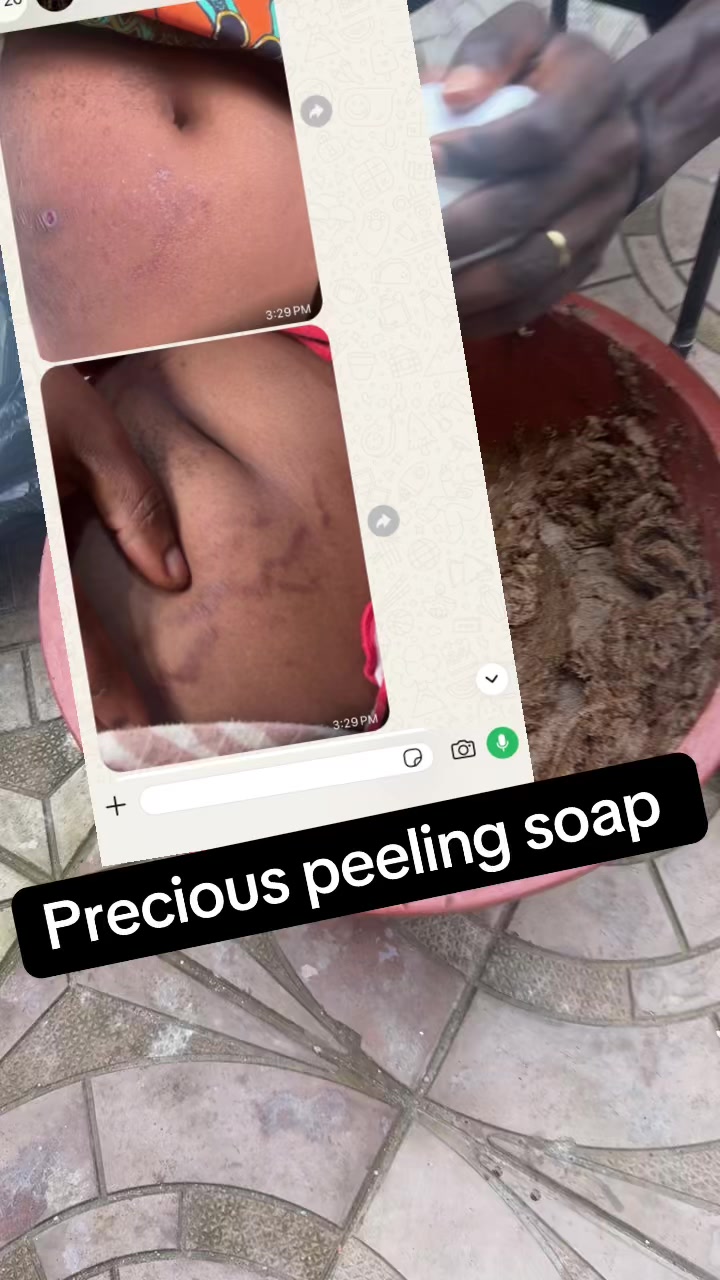 @@ Precious peeling soap