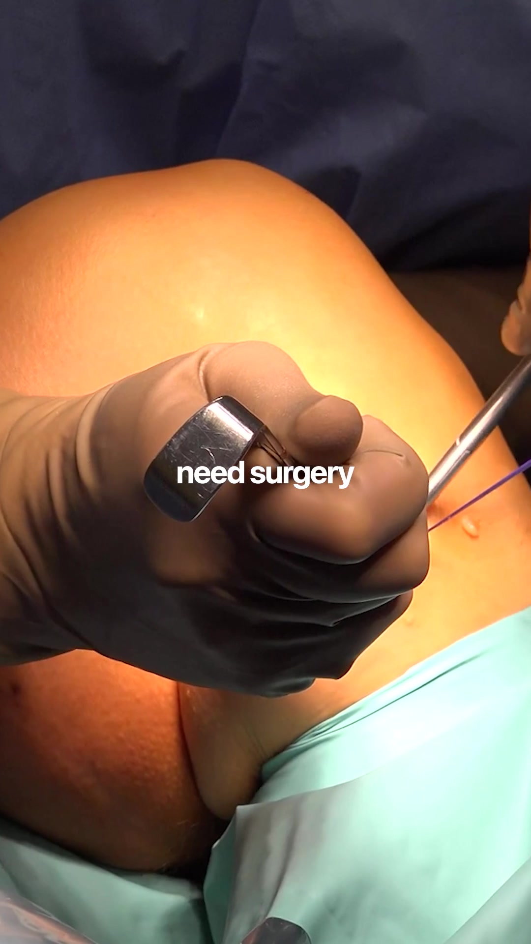 @YorkshireSportsKneeClinic