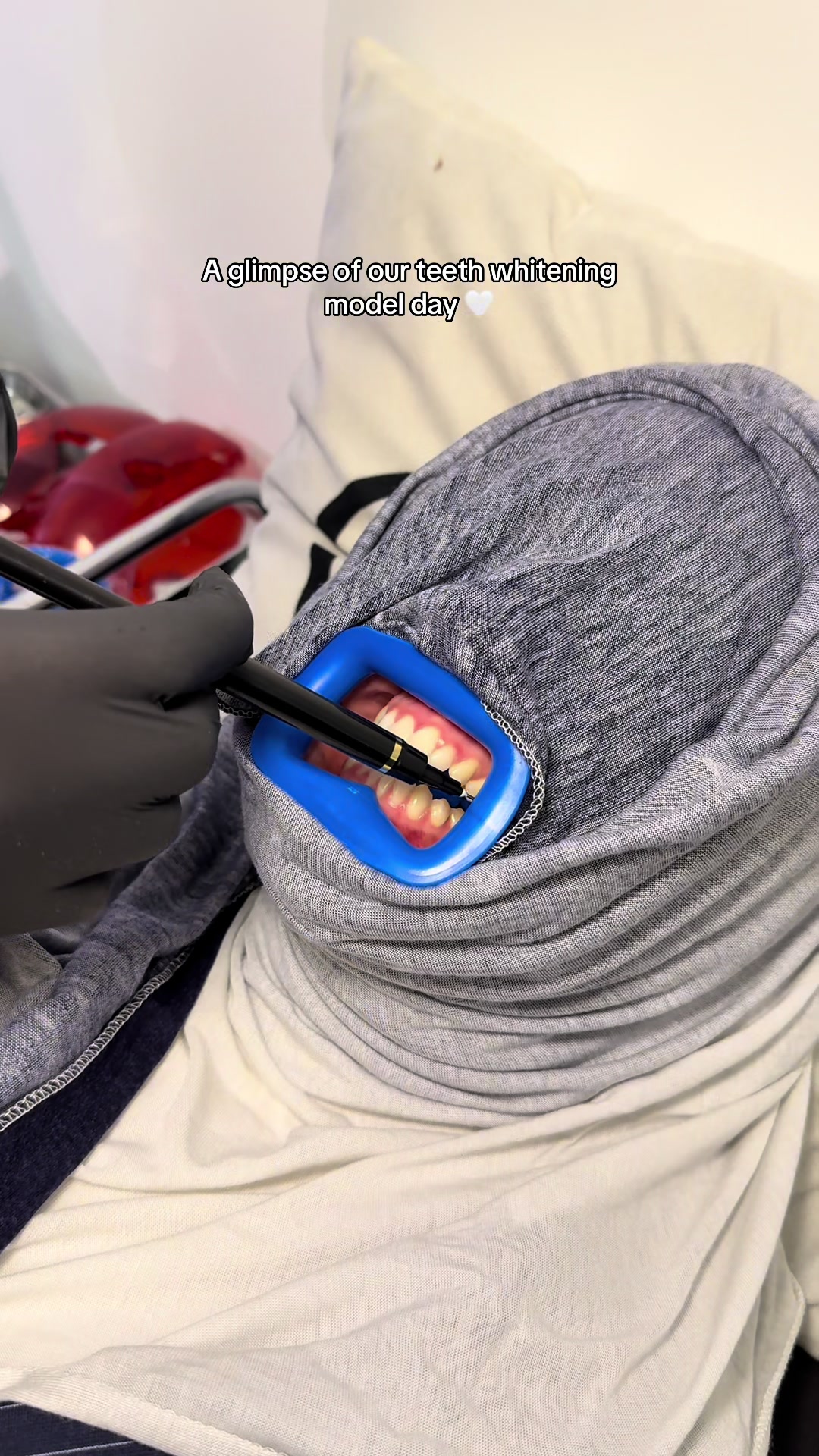@Halal Teeth Whitening London