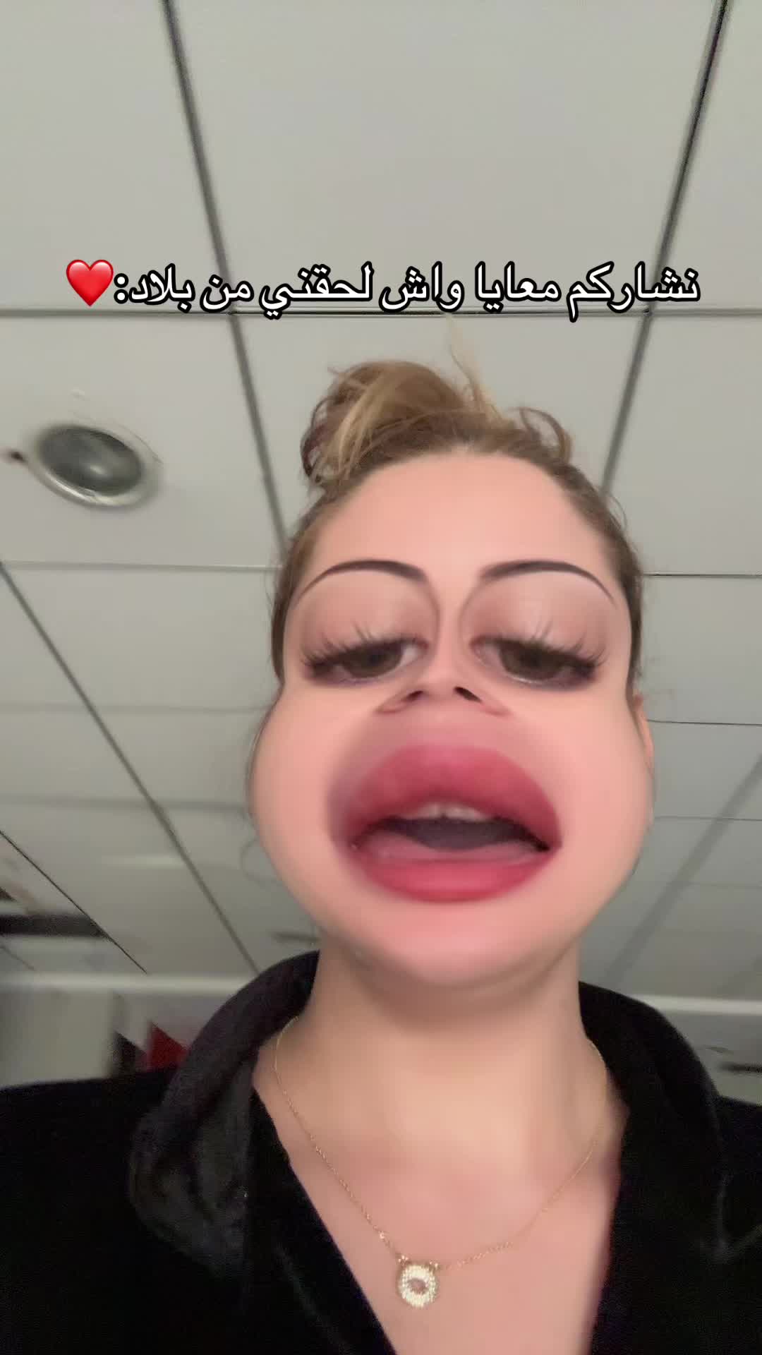 @La Noun en France ๐ซ๐ท
