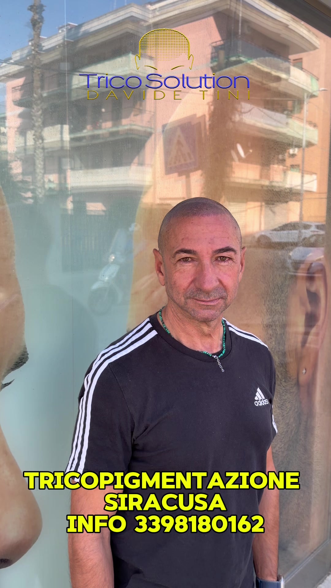 @TricoSolution di Davide Tini