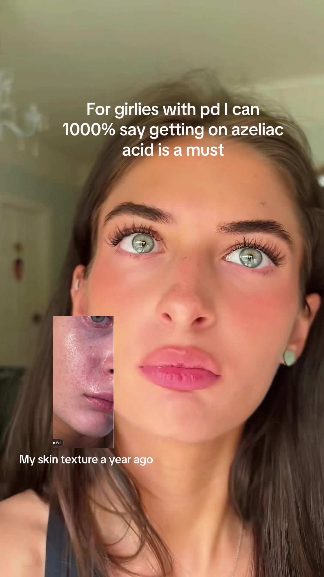 @merpz33