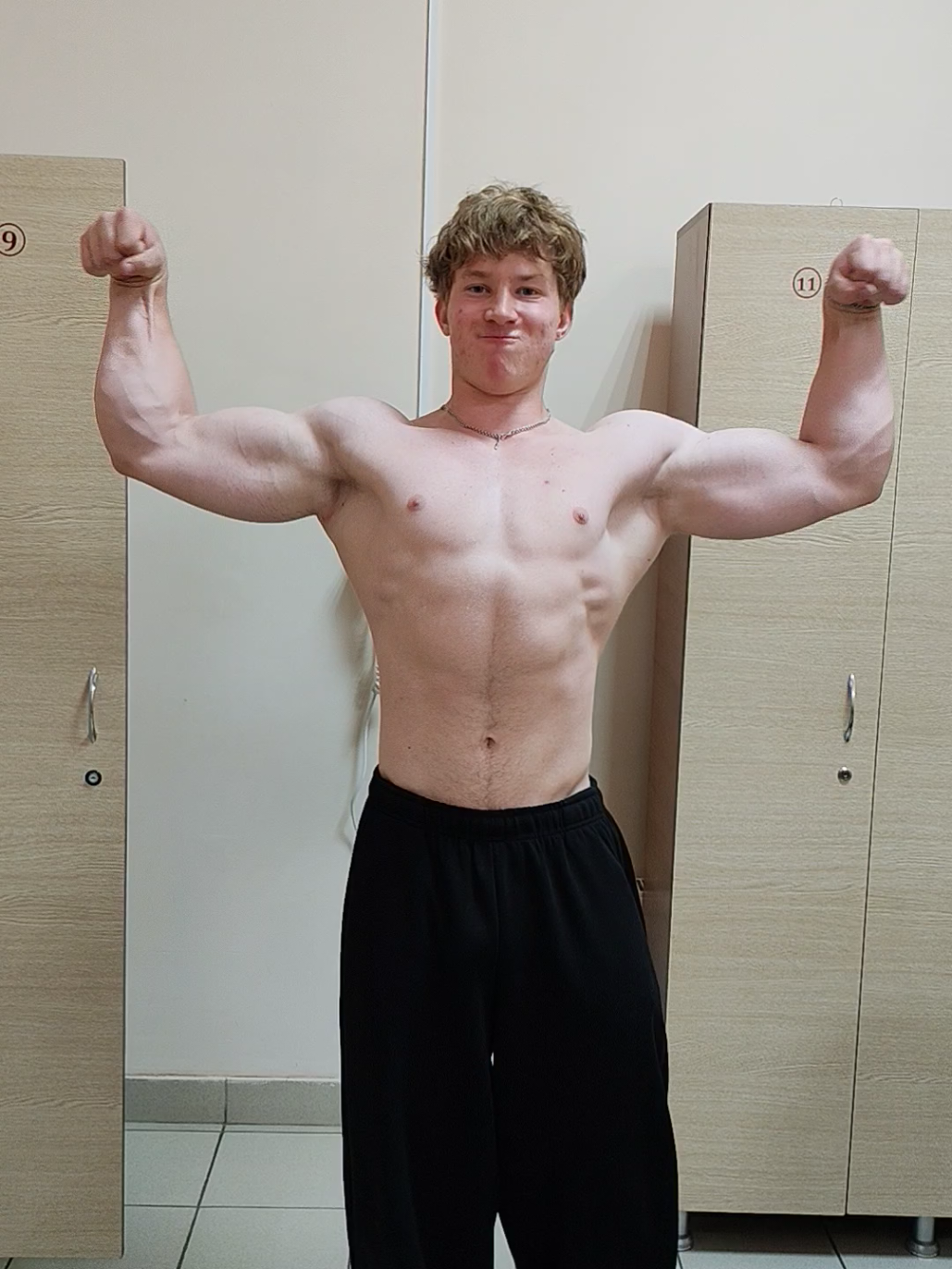 @ARM_Vnuk