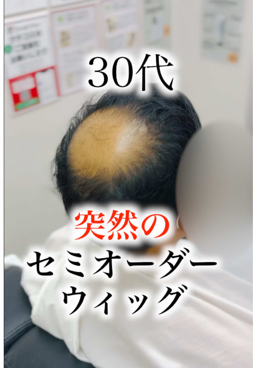 @even | 広島のオーダーウィッグ専門店