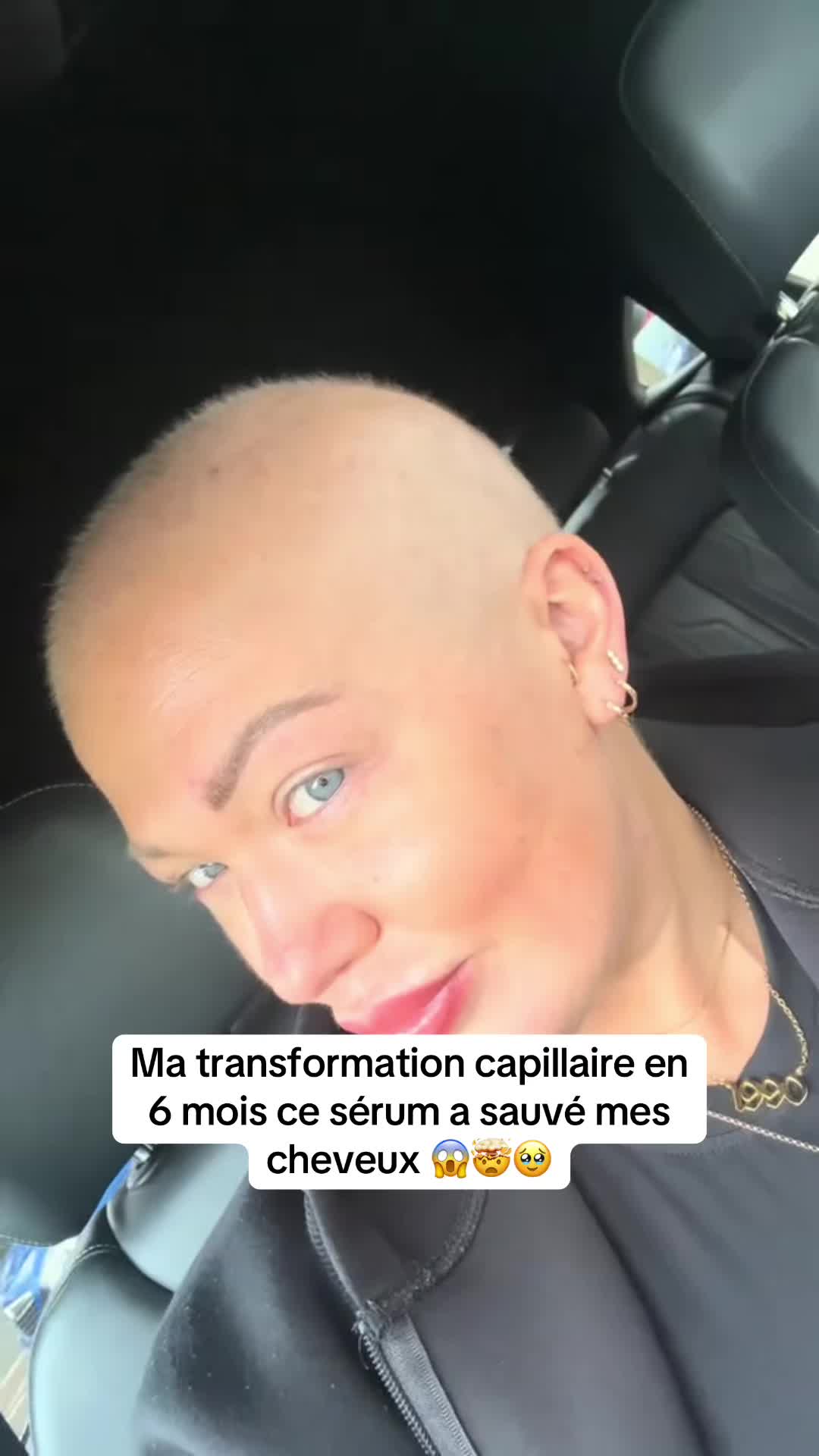 @Lux&rsquo;Hair Growth Paris