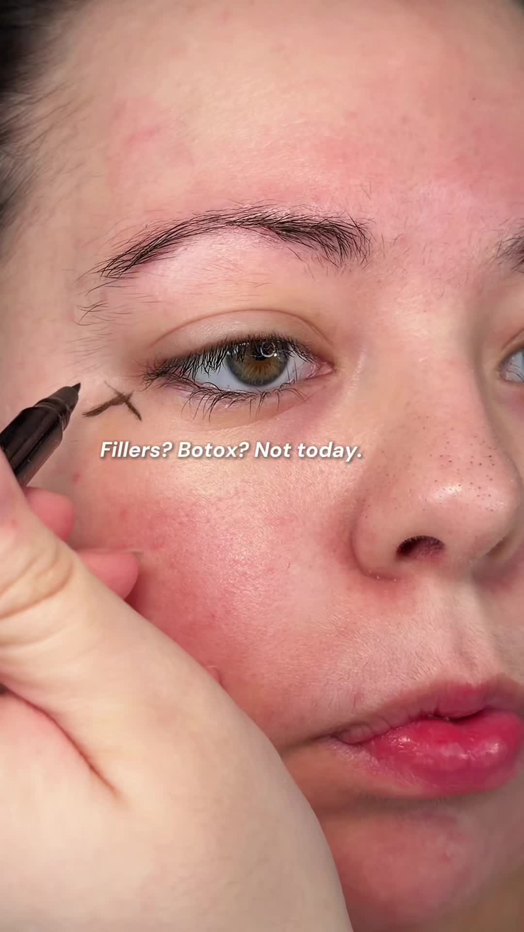 @Katie | Olive Skin + Beauty