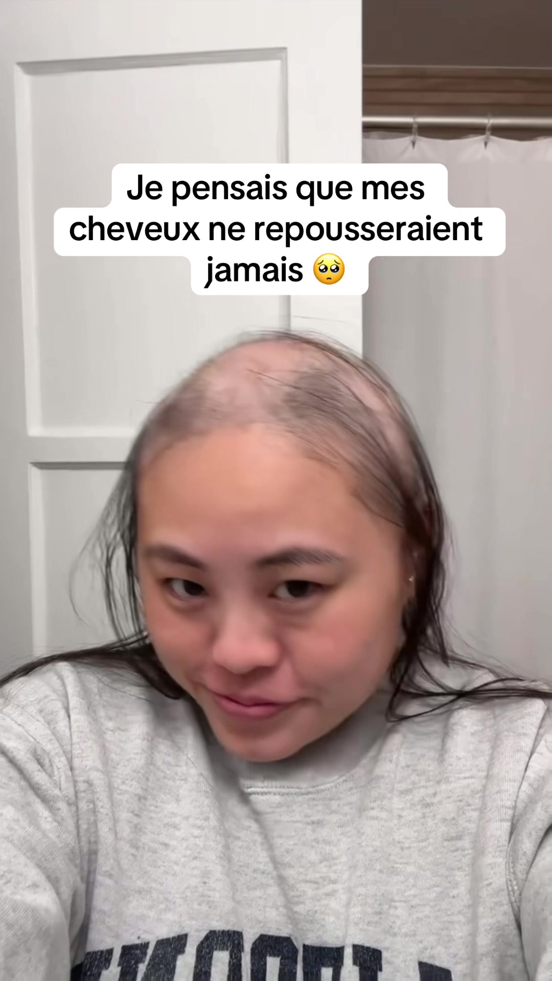 @Lux’Hair Growth Paris