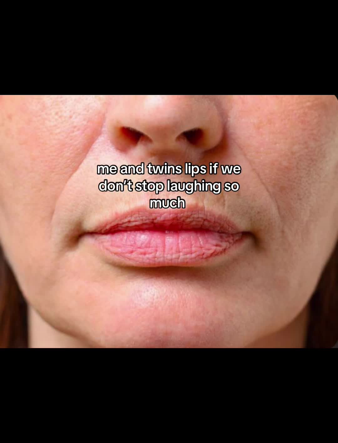 @:)