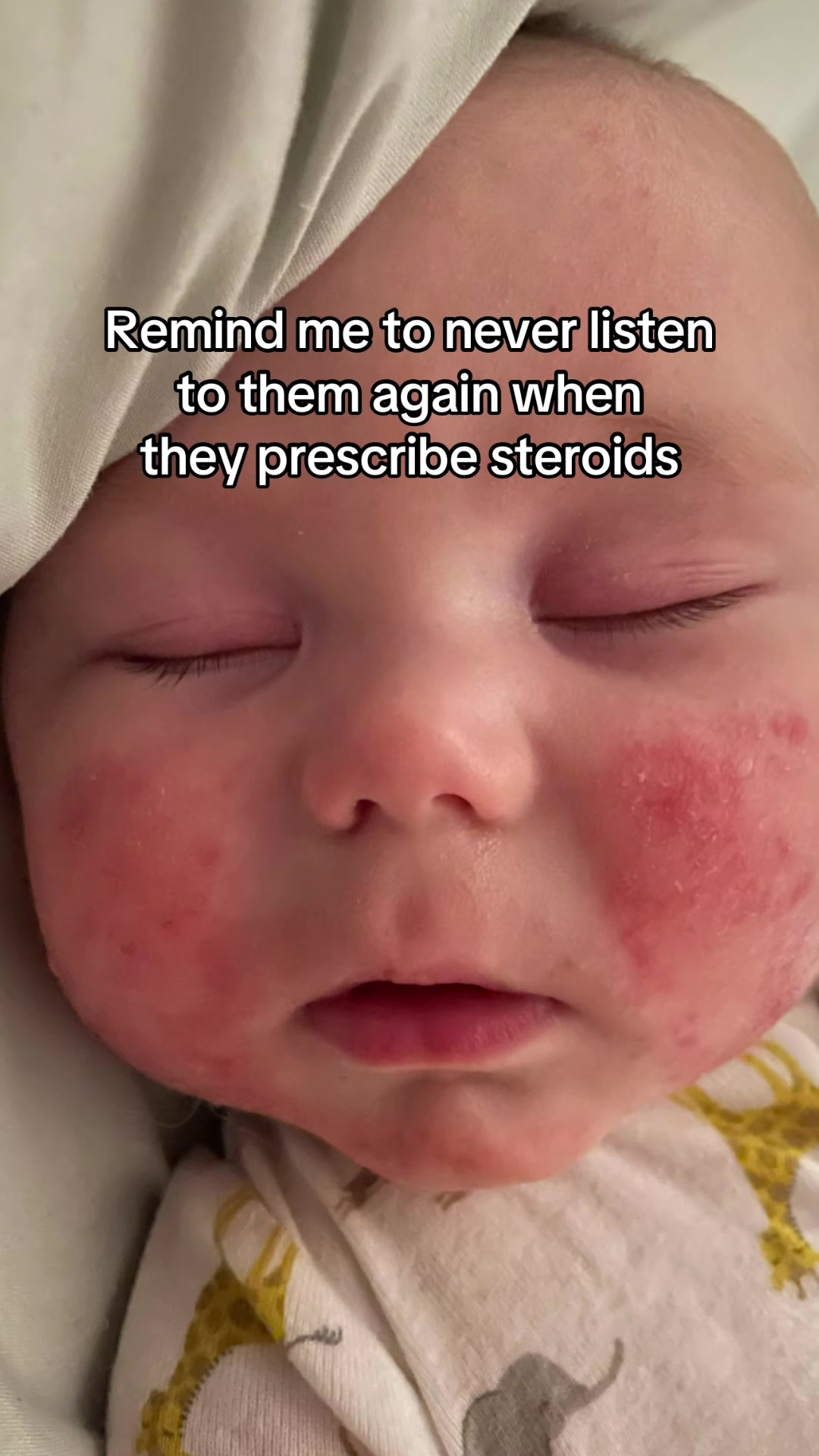 @Eczema Diaries USA & UK
