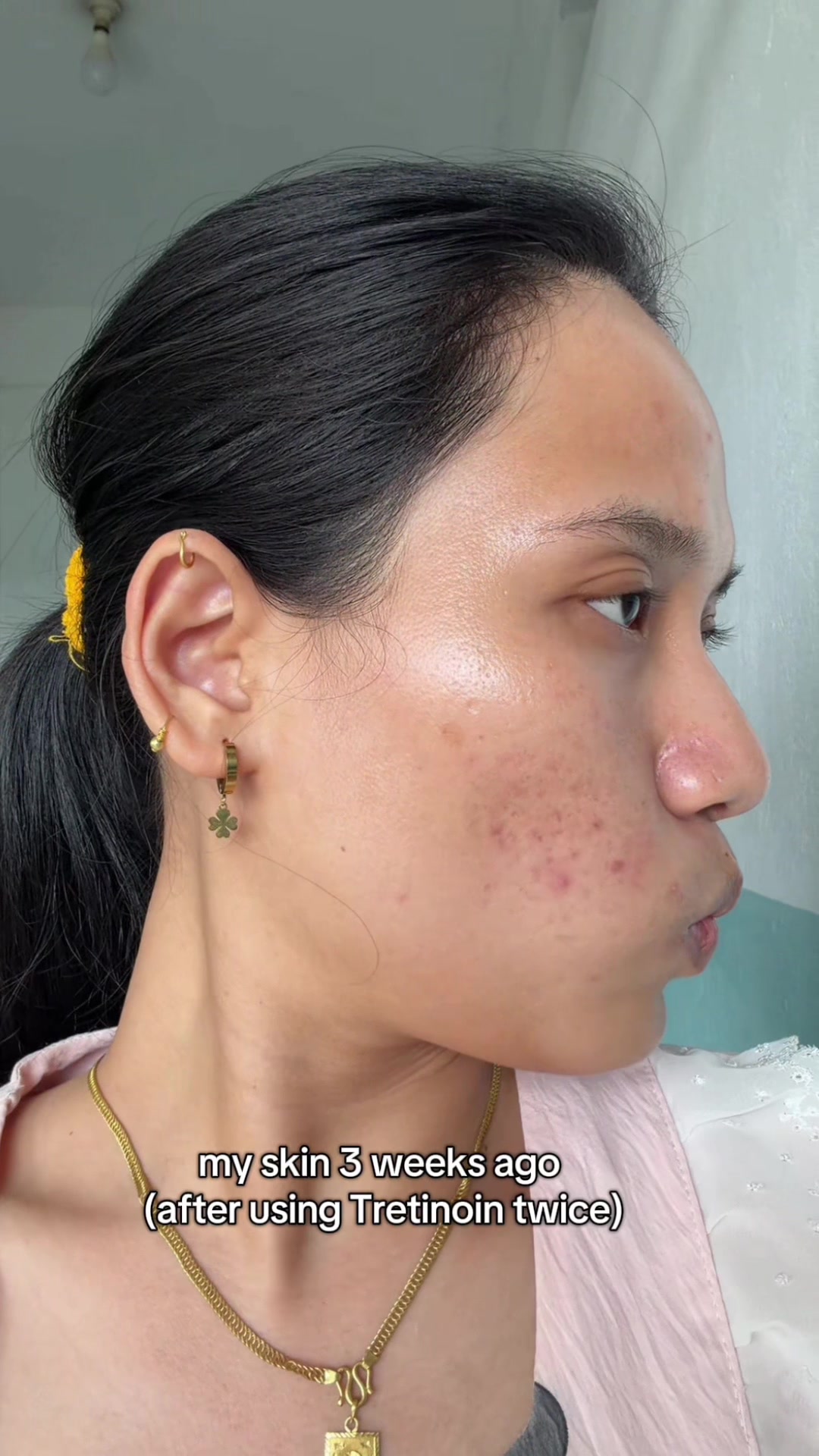 @Styleandskinbysanju
