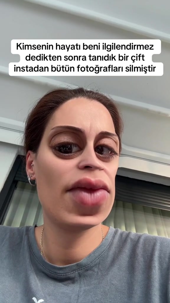 @eKe